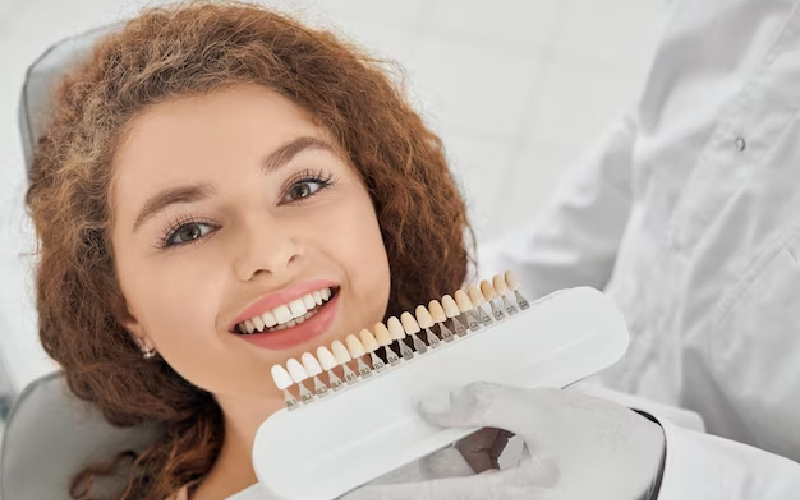 dental veneers in tucson