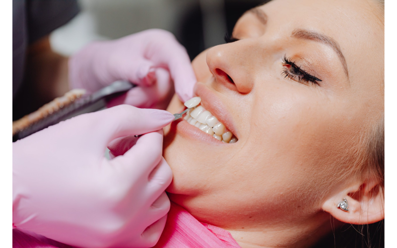 Dental Fillings in Houston
