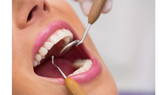Dental Emergency Myths Debunked: What You Need To Know?