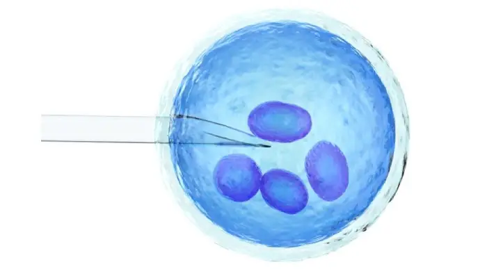 What Is IUI And How Can It Help You Start Your Family?